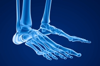 Shoes and Tarsal Tunnel Syndrome