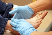 Proper Foot Care Is Essential in Diabetic Patients