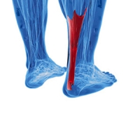 Can Achilles Tendon Injuries Be Prevented?